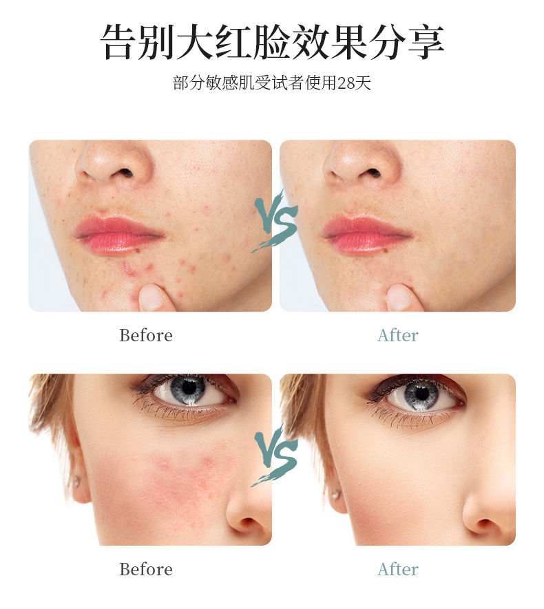 CBD套装_09.jpg 图片